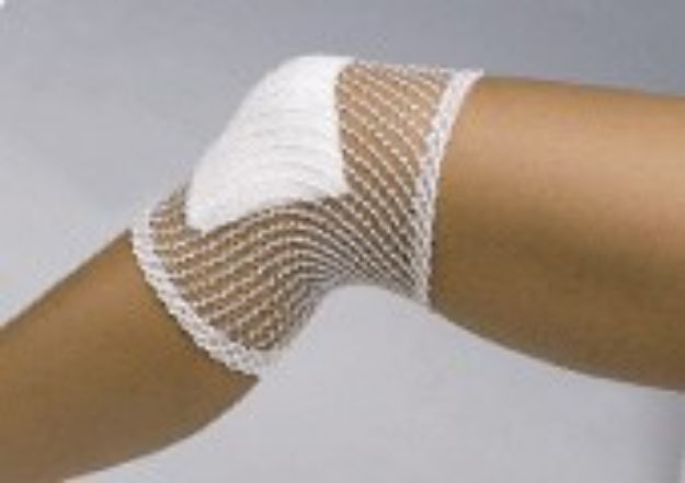 Afbeeldingen van TG Fix